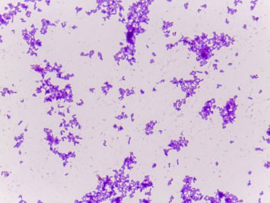Bir slaytta mor lekeli bakterilerin mikroskobik görüntüsü, çeşitli şekilleri ve boyutları, açık bir arka planı göstermektedir.