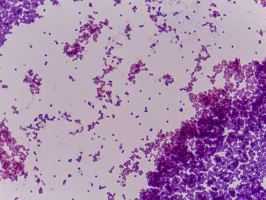 Kümeleri ve bireysel hücreleri gösteren mor lekeli bakterilerin mikroskobik görüntüsü