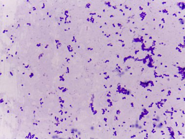 Camdaki mor lekeli bakterinin mikroskobik görüntüsü