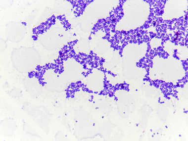 Beyaz zemin üzerine saçılmış mor lekeli hücrelerin mikroskobik görüntüsü, biyolojik bir örnek ya da doku parçasına benziyor.