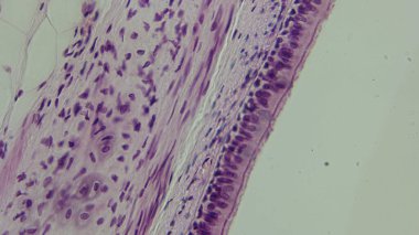 Mor hücreli dokunun mikroskobik görüntüsü, katmanlar ve hücresel yapıları gösteriyor