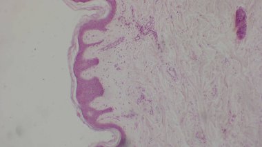 Deri dokusunun mikroskobik görüntüsü, pembe ve mor renklerle boyanmış katmanları ve hücre yapılarını gösteriyor.