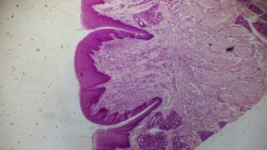 Doku bölümünün mikroskobik görüntüsü hücresel yapıları ve lekeleri gösteriyor, ağırlıklı olarak pembe ve mor tonlarda.