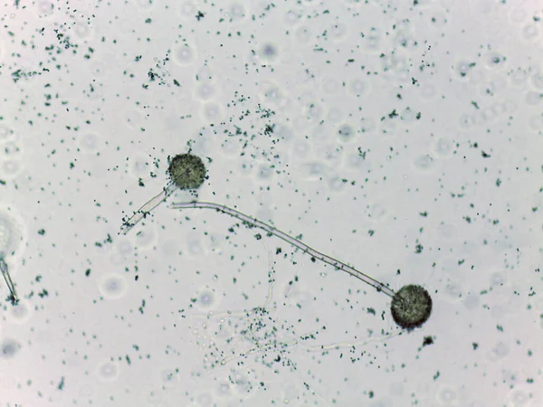 İki küresel mikroorganizmanın mikroskobik görüntüsü, daha küçük parçacıklarla çevrili bir filamanla birbirine bağlı.