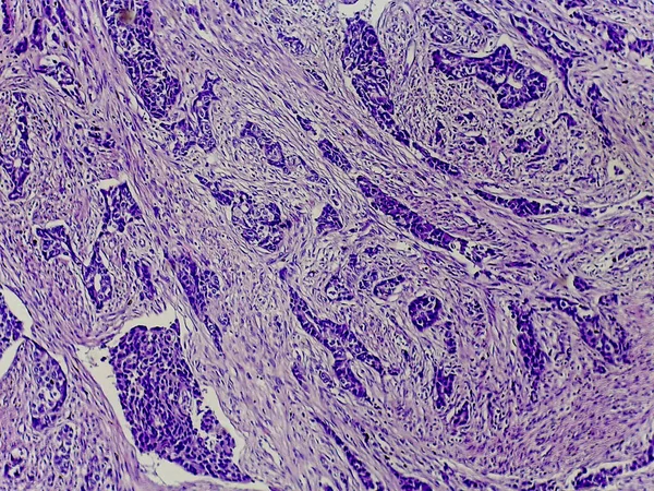 Mor lekeli dokunun mikroskobik görüntüsü, karmaşık hücresel yapılar ve desenler gösteriyor, biyolojik veya tıbbi araştırmaların göstergesi.