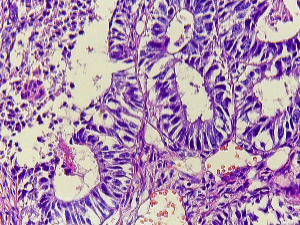 Mor hücreli ve yapılı dokunun mikroskobik görüntüsü, hücresel detayları ve kalıpları gösteriyor
