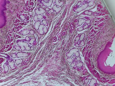 Yıldız Lumen Şeklini ve Epithelium ve Özfageal Bezlerin Katmanlarını Gösteren Özfaj Dokusunun Detaylı Tarihsel Mikrografı.