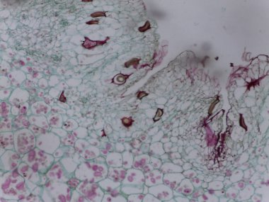 Senkronizasyon ile enfekte olmuş Patates Dokusunda lekelenmiş İntrelyel Dinlenme Sporları ve Konak Hipertrofisi.