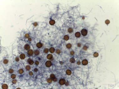 Mucorales Mantarlarının Cinsel Üreme Yapıları: Süslü Zygospores ve Aseptate Filaments 'ın Ayrıntılı Görüntüsü.