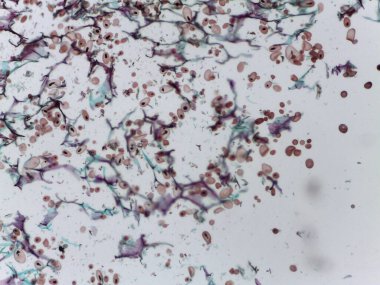 Plasmodiophoromycota Protist Spongia 'nın Detaylı Işık Mikroskopisi Solanum Tüberosum' da Toz Kabuğu Hastalığına Yol Açtı.