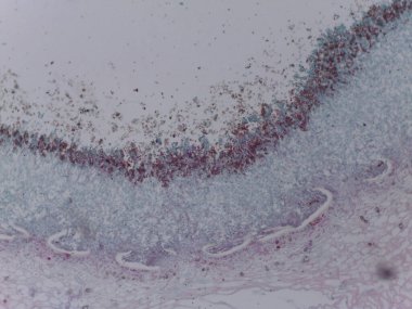 Penisilyum Mantar Konidia Sporunun Lekeli Mikrografı Mycology Araştırma için Conidiophores 'dan Çıktı.