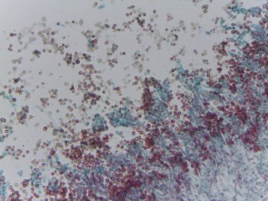 Penisilyum Mantar Konidia Sporunun Lekeli Mikrografı Mycology Araştırma için Conidiophores 'dan Çıktı.