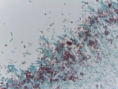 Penisilyum Mantar Konidia Sporunun Lekeli Mikrografı Mycology Araştırma için Conidiophores 'dan Çıktı.