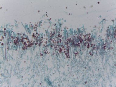 Penisilyum Mantar Konidia Sporunun Lekeli Mikrografı Mycology Araştırma için Conidiophores 'dan Çıktı.