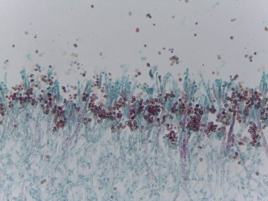 Penisilyum Mantar Konidia Sporunun Lekeli Mikrografı Mycology Araştırma için Conidiophores 'dan Çıktı.