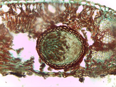 Ascomycota Cinsel Üreme Yapılarının Ayrıntılı Mikroskobik Görünümü: Peritekial Meyve Gövdesi içindeki Asci ve Sporlar.