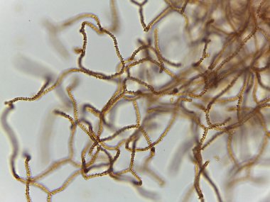 Sümük Küf Sporu Dağılımı Yapılarının Ayrıntılı Mikroskobik Görünümü: Arcyria Cins 'inin Karmaşık Kahverengi Başlıklı Konumları.