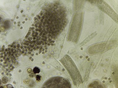 Saprolegnia Oomycete Cinsel Yapılar Lekesiz Mikrografı: Oogonia Gelişmekte Olan Oosporlarla Doludur.