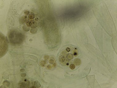 Saprolegnia Oomycete Cinsel Yapılar Lekesiz Mikrografı: Oogonia Gelişmekte Olan Oosporlarla Doludur.
