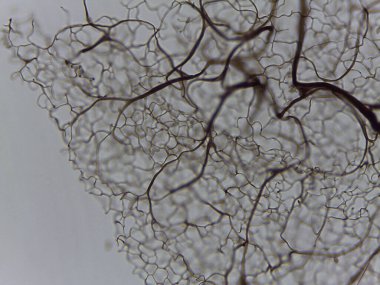 Stemonitis 'in Yüksek Yoğunluklu Mikroskobik Görünümü Sümük Küf Sporları ve Miksomycete Çalışması için Kapitalist Ağ Kalıntıları.