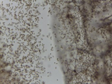 Stemonitis 'in Yüksek Yoğunluklu Mikroskobik Görünümü Sümük Küf Sporları ve Miksomycete Çalışması için Kapitalist Ağ Kalıntıları.