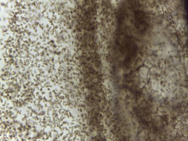 Stemonitis 'in Yüksek Yoğunluklu Mikroskobik Görünümü Sümük Küf Sporları ve Miksomycete Çalışması için Kapitalist Ağ Kalıntıları.