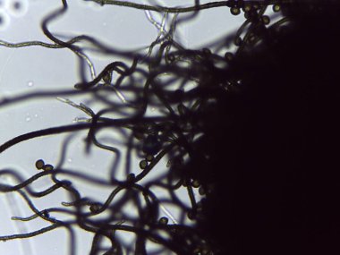 Chaetomium Mantar Peritekium 'un mikroskobik Görünümü, Taksonomik Tanımlama İçin Tanı Koyu ve Karmaşık Kıllar Gösteriliyor.