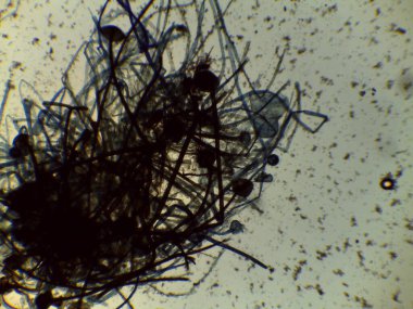 Filamentous Organizma Yapılarının Ayrıntılı Mikroskopisi: Karmaşık Hipsal Büyüme ve Terminal Küresel Üreme Organları.