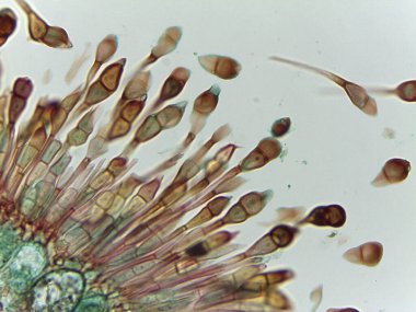 Basidiomycota Pas Mantar Yaşam Döngüsü: Olgunluk Hazırlığı Dikeloid Teliosporları ve Kış Yaşamı Sporu Gösterme Döngüsü.