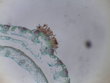 Basidiomycota Pas Mantar Yaşam Döngüsü: Olgunluk Hazırlığı Dikeloid Teliosporları ve Kış Yaşamı Sporu Gösterme Döngüsü.