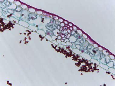 Hafif Ustilago Ustilago Tritici Teliospore Salımı Gevşek Smut Hastalığı.
