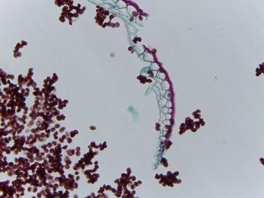 Hafif Ustilago Ustilago Tritici Teliospore Salımı Gevşek Smut Hastalığı.