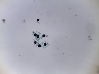 Toz Küf Mantarının Ayrıntılı Mikroskopisi Cinsel Aşama: Türlerin Tanımlanması İçin Uçbirim uzantıları ile Küresel Ascocarp.