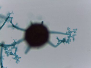 Toz Küf Mantarının Ayrıntılı Mikroskopisi Cinsel Aşama: Türlerin Tanımlanması İçin Uçbirim uzantıları ile Küresel Ascocarp.