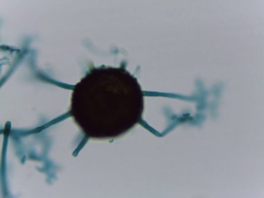 Toz Küf Mantarının Ayrıntılı Mikroskopisi Cinsel Aşama: Türlerin Tanımlanması İçin Uçbirim uzantıları ile Küresel Ascocarp.