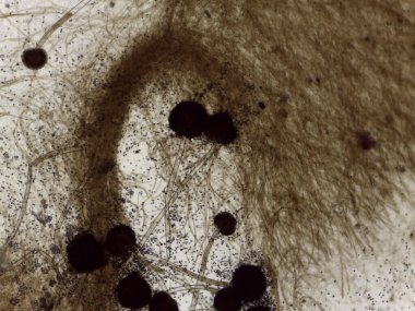 Aspergillus Mantarlarının Açık Mikrografı: Karanlık Küresel Konidial Başlar ve Mitoloji Araştırmaları için Hyphal Ağı.