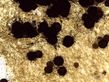 Aspergillus Mantarlarının Açık Mikrografı: Karanlık Küresel Konidial Başlar ve Mitoloji Araştırmaları için Hyphal Ağı.