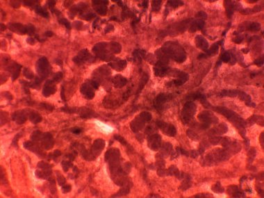 Hepatik Doku Mikrografı Nekroz ve Hemorajik Foci 'yi Gösteriyor Fasciola Bilgileriyle İlişkili