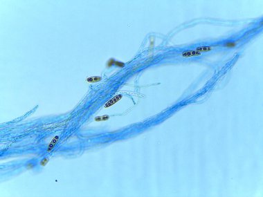 Hyphae içinde Çok Sporlu Asci 'nin (Ascospores) Lekeli Işık Mikrografı, Ascomycota' da Cinsel Üremeyi Belirtir