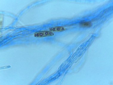 Hyphae içinde Çok Sporlu Asci 'nin (Ascospores) Lekeli Işık Mikrografı, Ascomycota' da Cinsel Üremeyi Belirtir