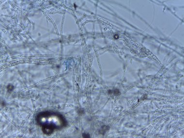 Filamentous Mantar Yapısı 'nın Ayrıntılı Mikroskopisi: Kalın Duvarlı Hücreler ve Sulu Hazırlıklı Görünür Septa.