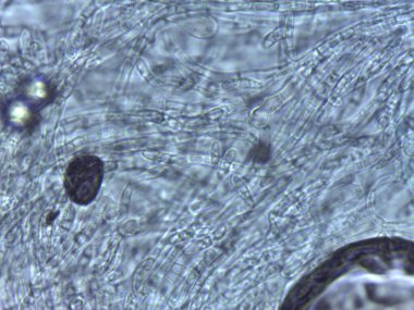 Filamentous Mantar Yapısı 'nın Ayrıntılı Mikroskopisi: Kalın Duvarlı Hücreler ve Sulu Hazırlıklı Görünür Septa.