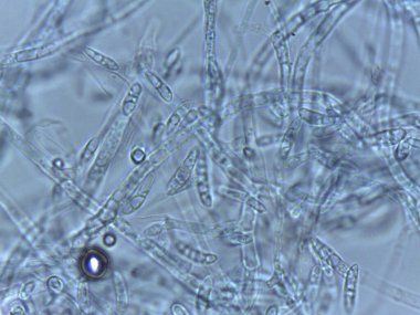 Filamentous Mantar Yapısı 'nın Ayrıntılı Mikroskopisi: Kalın Duvarlı Hücreler ve Sulu Hazırlıklı Görünür Septa.