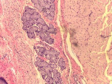 Üst Eksofageal Katmanların Detaylı Tarihsel Mikrografı Mucosa, Submucosal Bezeler ve Çizgili İskelet