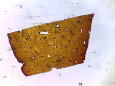 Haversian Sistemi 'ni (Osteon) Vurgulayan İnsan Sıkıştırılmış Kemik Dokusunun Zemin Bölümü Mikrografı.