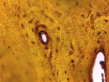 Haversian Sistemi 'ni (Osteon) Vurgulayan İnsan Sıkıştırılmış Kemik Dokusunun Zemin Bölümü Mikrografı.