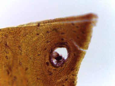 Haversian Sistemi 'ni (Osteon) Vurgulayan İnsan Sıkıştırılmış Kemik Dokusunun Zemin Bölümü Mikrografı.