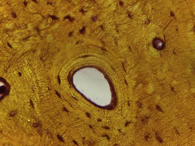 Haversian Sistemi 'ni (Osteon) Vurgulayan İnsan Sıkıştırılmış Kemik Dokusunun Zemin Bölümü Mikrografı.