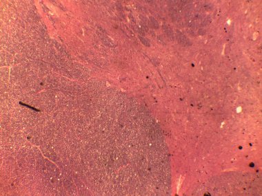 Memeli Lenf Korteksinin H & E Lekeli Mikrografı Lenf Sinüsleri tarafından ayrılmış Yoğun Lenfoid Folitlerini Gösteriyor.