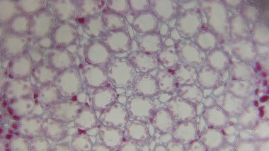 Görünür hücre duvarları ve çekirdekleri olan bitki hücrelerinin mikroskobik görüntüsü.